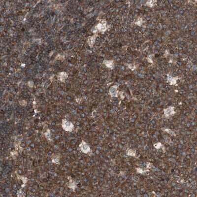 Immunohistochemistry-Paraffin: TCP11L1 Antibody [NBP1-83749] - Staining of human lymph node shows strong cytoplasmic positivity in reaction center cells and lymphoid cells outside reaction center.