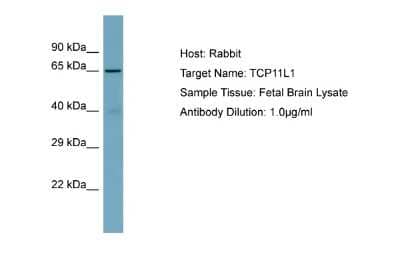 Western Blot: TCP11L1 Antibody [NBP2-83634] - Host: Rabbit. Target Name: TCP11L1. Sample Type: Fetal Brain lysates. Antibody Dilution: 1.0ug/ml