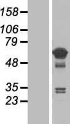 Western Blot: TCP11L1 Overexpression Lysate (Adult Normal) [NBL1-16789] Left-Empty vector transfected control cell lysate (HEK293 cell lysate); Right -Over-expression Lysate for TCP11L1.