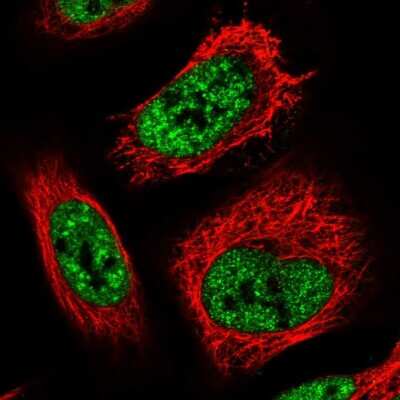 Immunocytochemistry/Immunofluorescence: TCP11L2 Antibody [NBP1-82694] - Immunofluorescent staining of human cell line U-2 OS shows localization to nuclear speckles.