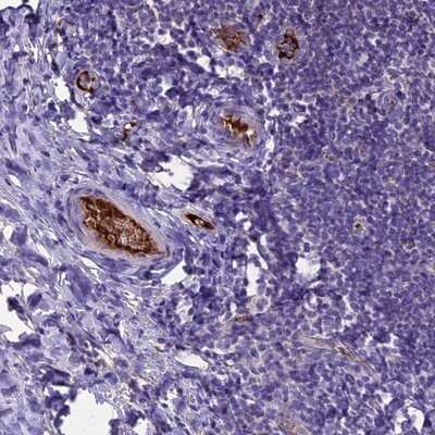 Immunohistochemistry-Paraffin: TCP11L2 Antibody [NBP1-82695] - Staining of human tonsil shows distinct positivity in plasma.