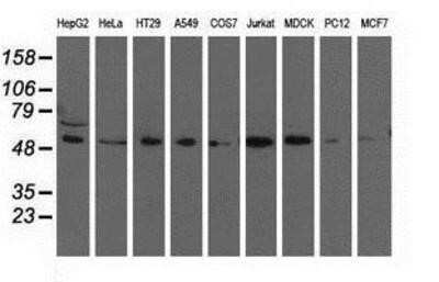 Western Blot: TCP11L2 Antibody (OTI2A10) - Azide and BSA Free [NBP2-74477] - Analysis of extracts (35ug) from 9 different cell lines by using anti-TCP11L2 monoclonal antibody.