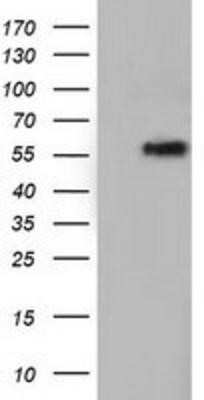 Western Blot: TCP11L2 Antibody (OTI2A10) - Azide and BSA Free [NBP2-74477] - HEK293T cells were transfected with the pCMV6-ENTRY control (Left lane) or pCMV6-ENTRY TCP11L2 (Right lane) cDNA for 48 hrs and lysed. Equivalent amounts of cell lysates (5 ug per lane) were separated by SDS-PAGE and immunoblotted with anti-TCP11L2.
