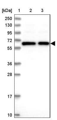 Western Blot: TCP11L2 Antibody [NBP1-82694] - Lane 1: Marker  [kDa] 250, 130, 95, 72, 55, 36, 28, 17, 10.  Lane 2: Human cell line RT-4.  Lane 3: Human cell line U-251MG sp