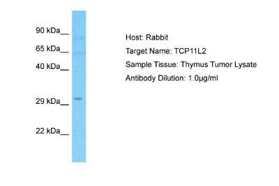 Western Blot: TCP11L2 Antibody [NBP2-88426] - Host: Rabbit. Target Name: TCP11L2. Sample Type: Thymus Tumor lysates. Antibody Dilution: 1.0ug/ml