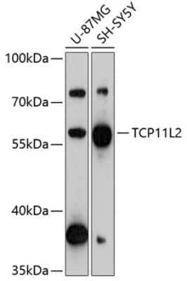 Western Blot: TCP11L2 Antibody [NBP2-93924] - Analysis of extracts of various cell lines, using TCP11L2 at 1:3000 dilution. Secondary antibody: HRP Goat Anti-Rabbit IgG (H+L) at 1:10000 dilution. Lysates/proteins: 25ug per lane. Blocking buffer: 3% nonfat dry milk in TBST. Detection: ECL Basic Kit . Exposure time: 90s.