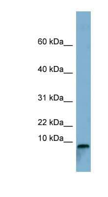 Western Blot: TCTA Antibody [NBP1-59828] - Human Stomach, concentration 0.2-1 ug/ml.