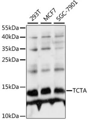 Western Blot: TCTA Antibody [NBP2-94682] - Analysis of extracts of various cell lines, using TCTA at 1:1000 dilution. Secondary antibody: HRP Goat Anti-Rabbit IgG (H+L) at 1:10000 dilution. Lysates/proteins: 25ug per lane. Blocking buffer: 3% nonfat dry milk in TBST. Detection: ECL Basic Kit . Exposure time: 3s.