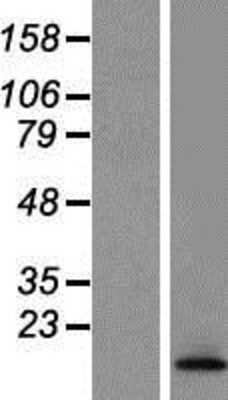 Western Blot: TCTA Overexpression Lysate (Adult Normal) [NBP2-06451] Left-Empty vector transfected control cell lysate (HEK293 cell lysate); Right -Over-expression Lysate for TCTA.