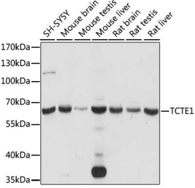 Western Blot: TCTE1 Antibody [NBP2-94592] - Analysis of extracts of various cell lines, using TCTE1 at 1:1000 dilution. Secondary antibody: HRP Goat Anti-Rabbit IgG (H+L) at 1:10000 dilution. Lysates/proteins: 25ug per lane. Blocking buffer: 3% nonfat dry milk in TBST. Detection: ECL Basic Kit . Exposure time: 15s.