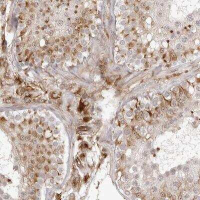 Immunohistochemistry-Paraffin: TCTEX1D1 Antibody [NBP1-93777] - Staining of human testis shows cytoplasmic positivity in leydig and Sertoli cells.
