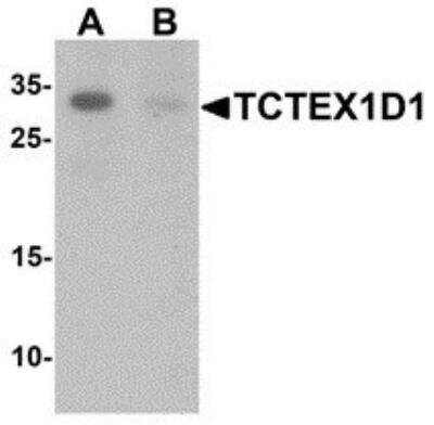 Western Blot: TCTEX1D1 Antibody [NBP2-81830] - Analysis of TCTEX1D1 in K562 cell lysate with TCTEX1D1 antibody at 1 ug/ml in (A) the absence and (B) the presence of blocking peptide.