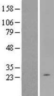 Western Blot: TCTEX1D1 Overexpression Lysate (Adult Normal) [NBP2-05325] Left-Empty vector transfected control cell lysate (HEK293 cell lysate); Right -Over-expression Lysate for TCTEX1D1.
