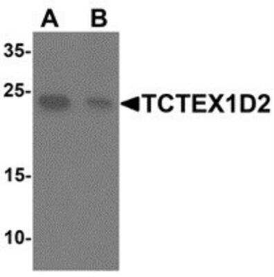 Western Blot: TCTEX1D2 Antibody [NBP2-81831] - Analysis of TCTEX1D2 in K652 cell lysate with TCTEX1D2 antibody at 1 ug/ml in (A) the absence and (B) the presence of blocking peptide.