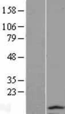 Western Blot: TCTEX1D2 Overexpression Lysate (Adult Normal) [NBL1-16792] Left-Empty vector transfected control cell lysate (HEK293 cell lysate); Right -Over-expression Lysate for TCTEX1D2.
