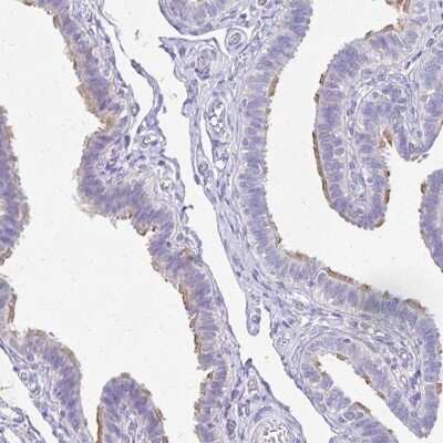 Immunohistochemistry-Paraffin: TCTEX1D4 Antibody [NBP2-32366] - Staining of human fallopian tube shows high expression.