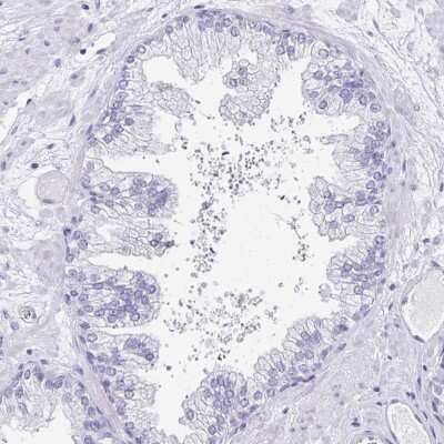 Immunohistochemistry-Paraffin: TCTEX1D4 Antibody [NBP2-32366] - Staining of human prostate shows low expression as expected.