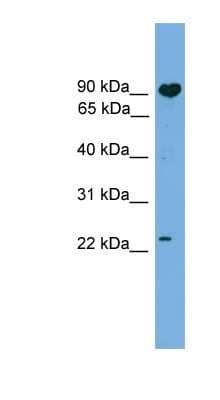 Western Blot: TCTEX1D4 Antibody [NBP1-70719] - 721_B cell lysate, concentration 0.2-1 ug/ml.