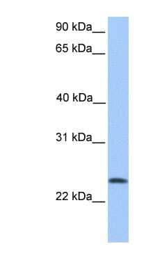 Western Blot: TCTEX1D4 Antibody [NBP1-70720] - 721_B cell lysate, concentration 0.2-1 ug/ml.