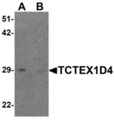 Western Blot: TCTEX1D4 Antibody [NBP2-81863] - Analysis of TCTEX1D4 in mouse liver tissue lysate with TCTEX1D4 antibody at 1 ug/ml in (A) the absence and (B) the presence of blocking peptide.