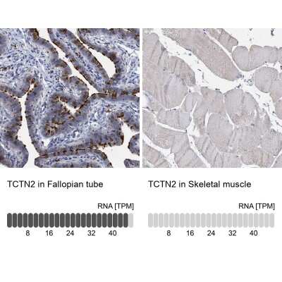 Immunohistochemistry-Paraffin: TCTN2 Antibody [NBP1-88392] - Staining in human fallopian tube and skeletal muscle tissues using anti-TCTN2 antibody. Corresponding TCTN2 RNA-seq data are presented for the same tissues.