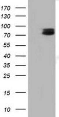 Western Blot: TCTN2 Antibody (OTI1C1) - Azide and BSA Free [NBP2-74483] - HEK293T cells were transfected with the pCMV6-ENTRY control (Left lane) or pCMV6-ENTRY TCTN2 (Right lane) cDNA for 48 hrs and lysed. Equivalent amounts of cell lysates (5 ug per lane) were separated by SDS-PAGE and immunoblotted with anti-TCTN2.