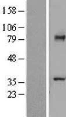 Western Blot: TCTN2 Overexpression Lysate (Adult Normal) [NBL1-16795] Left-Empty vector transfected control cell lysate (HEK293 cell lysate); Right -Over-expression Lysate for TCTN2.