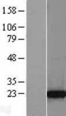 Western Blot TPT1/TCTP Overexpression Lysate