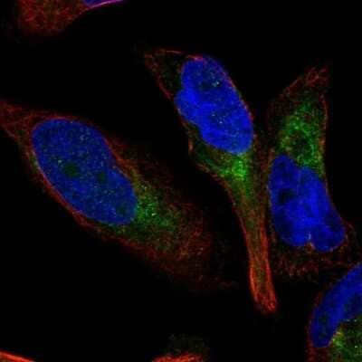 Immunocytochemistry/Immunofluorescence: TDAG8/GPR65 Antibody [NBP2-58485] - Staining of human cell line RH-30 shows localization to cytosol. Antibody staining is shown in green.