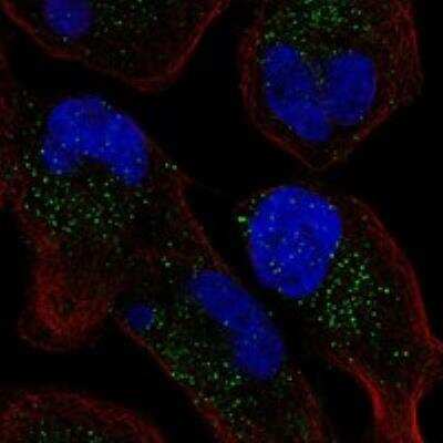 Immunocytochemistry/Immunofluorescence: TDAG8/GPR65 Antibody [NBP3-17093] - Staining of human cell line RH-30 shows localization to vesicles.