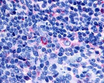 Immunohistochemistry-Paraffin: TDAG8/GPR65 Antibody [NLS1625] - Analysis of anti-GPR65 / TDAG8 antibody with tonsil at 4 ug/ml.