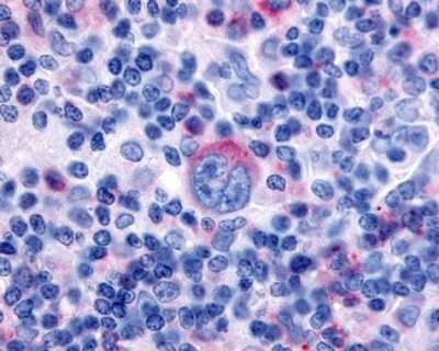 Immunohistochemistry-Paraffin: TDAG8/GPR65 Antibody [NLS1625] - Analysis of anti-GPR65 / TDAG8 antibody with human lymph node, Hodgkins lymphoma.