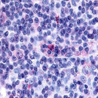 Immunohistochemistry-Paraffin: TDAG8/GPR65 Antibody [NLS1627] - Analysis of anti-GPR65 / TDAG8 antibody with human lymph node, Hodgkins lymphoma.