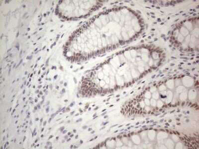 Immunohistochemistry: TDG Antibody (OTI3C11) - Azide and BSA Free [NBP2-74484] - Analysis of Human colon tissue. (Heat-induced epitope retrieval by 1mM EDTA in 10mM Tris buffer (pH8.5) at 120C for 3 min)