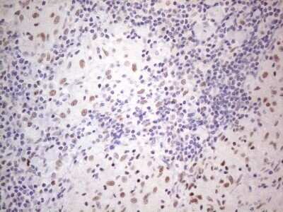 Immunohistochemistry: TDG Antibody (OTI3C11) - Azide and BSA Free [NBP2-74484] - Analysis of Human lymph node tissue. (Heat-induced epitope retrieval by 1mM EDTA in 10mM Tris buffer (pH8.5) at 120C for 3 min)