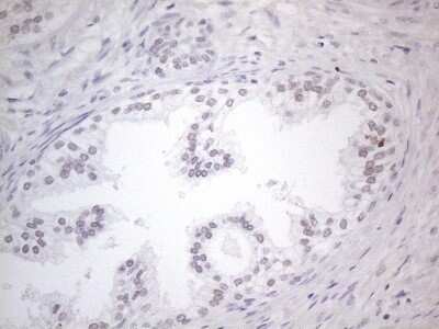 Immunohistochemistry: TDG Antibody (OTI3C11) - Azide and BSA Free [NBP2-74484] - Analysis of Human prostate tissue. (Heat-induced epitope retrieval by 1mM EDTA in 10mM Tris buffer (pH8.5) at 120C for 3 min)