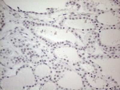 Immunohistochemistry: TDG Antibody (OTI3C11) - Azide and BSA Free [NBP2-74484] - Analysis of Human thyroid tissue. (Heat-induced epitope retrieval by 1mM EDTA in 10mM Tris buffer (pH8.5) at 120C for 3 min)