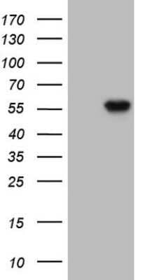 Western Blot: TDG Antibody (OTI3C11) - Azide and BSA Free [NBP2-74484] - Analysis of HEK293T cells were transfected with the pCMV6-ENTRY control (Left lane) or pCMV6-ENTRY TDG.