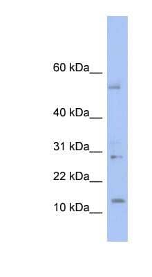 Western Blot: TDI Antibody [NBP1-70721] - Human Thymus lysate, concentration 0.2-1 ug/ml.