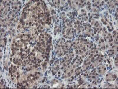 Immunohistochemistry-Paraffin: TDO2 Antibody (OTI2A4) [NBP2-45995] -  Staining of paraffin-embedded Human pancreas tissue within the normal limits using anti-TDO2 mouse monoclonal antibody. (Heat-induced epitope retrieval by 10mM citric buffer, pH6.0, 100C for 10min.