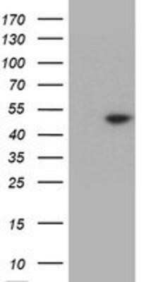 Western Blot: TDO2 Antibody (OTI1D1) - Azide and BSA Free [NBP2-74485] - HEK293T cells were transfected with the pCMV6-ENTRY control (Left lane) or pCMV6-ENTRY TDO2 (Right lane) cDNA for 48 hrs and lysed. Equivalent amounts of cell lysates (5 ug per lane) were separated by SDS-PAGE and immunoblotted with anti-TDO2.