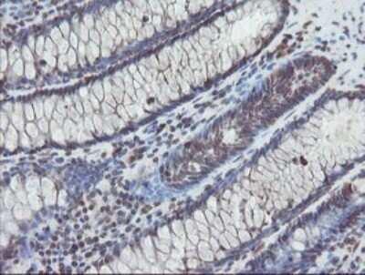 Immunohistochemistry: TDO2 Antibody (OTI2A4) - Azide and BSA Free [NBP2-74486] - Staining of paraffin-embedded Human colon tissue within the normal limits using anti-TDO2 mouse monoclonal antibody. (Heat-induced epitope retrieval by 10mM citric buffer, pH6.0, 100C for 10min.