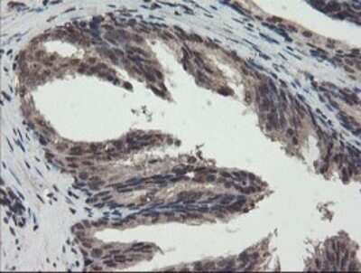 Immunohistochemistry: TDO2 Antibody (OTI2A4) - Azide and BSA Free [NBP2-74486] - Staining of paraffin-embedded Human prostate tissue within the normal limits using anti-TDO2 mouse monoclonal antibody. (Heat-induced epitope retrieval by 10mM citric buffer, pH6.0, 100C for 10min.