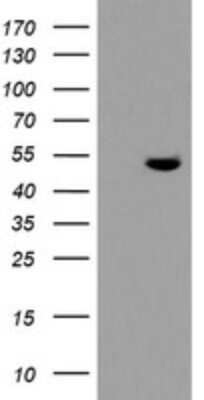 Western Blot: TDO2 Antibody (OTI2A4) - Azide and BSA Free [NBP2-74486] - Analysis of HEK293T cells were transfected with the pCMV6-ENTRY control (Left lane) or pCMV6-ENTRY TDO2.