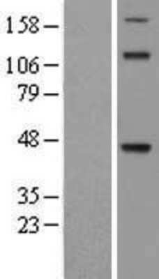 Western Blot: TDO2 Overexpression Lysate (Adult Normal) [NBL1-16799] Left-Empty vector transfected control cell lysate (HEK293 cell lysate); Right -Over-expression Lysate for TDO2.