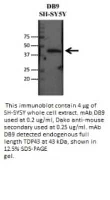 Western Blot: TDP-43/TARDBP Antibody (DB9) [NBP2-50331]