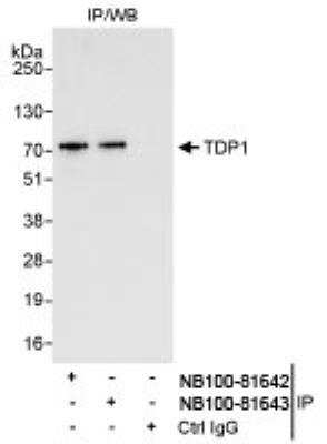 Immunoprecipitation: TDP1 Antibody [NB100-81643] - Detection of Human TDP1 by Western Blot of  Immunoprecipitates. Samples: Whole cell lysate (1 mg for IP,  20% of IP loaded) from HeLa cells. Antibodies: Affinity purified  rabbit anti-TDP1 antibody NB100-81643 used for IP at 3 mcg/mg  lysate. TDP1 was also immunoprecipitated by rabbit anti-TDP1  antibody NB100-81642, which recognizes an upstream epitope. Detection: Chemiluminescence with  an exposure time of 10 seconds.