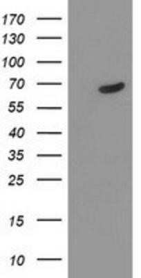 Western Blot: TDP1 Antibody (OTI4H1) - Azide and BSA Free [NBP2-74487] - HEK293T cells were transfected with the pCMV6-ENTRY control (Left lane) or pCMV6-ENTRY TDP1 (Right lane) cDNA for 48 hrs and lysed. Equivalent amounts of cell lysates (5 ug per lane) were separated by SDS-PAGE and immunoblotted with anti-TDP1.