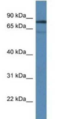 Western Blot: TDP1 Antibody [NBP1-74175] - Mouse Brain Lysate 1 ug/ml Gel Concentration 12%