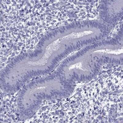 Immunohistochemistry-Paraffin: TDRD1 Antibody [NBP1-84349] - Staining of human endometrium shows low expression as expected.